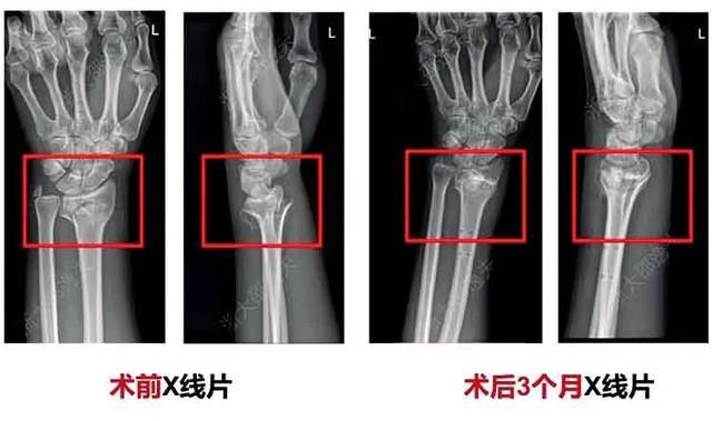 世界性难题,攻克了?